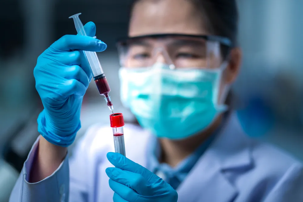 Nowe metody walki z dopingiem. Analiza suchej krwi batem na oszustów