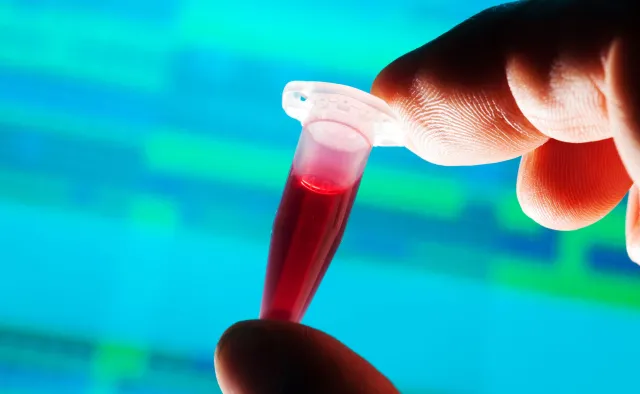 Problemy z krzepnięciem krwi – to może być małopłytkowość. Czym jest i jak ją leczyć?