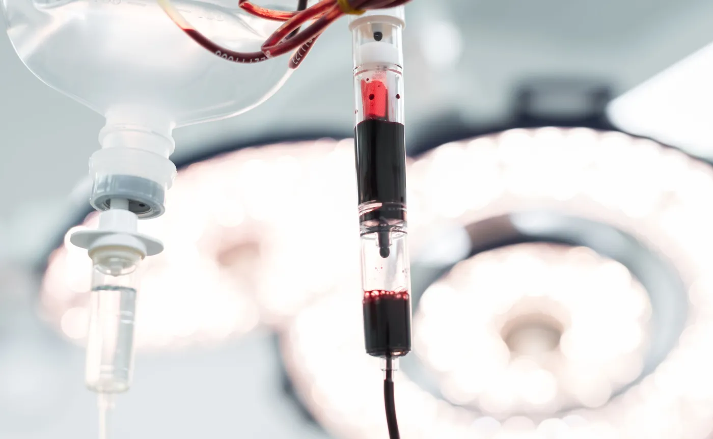 Badania: Osocze ozdrowieńców u ciężko chorych na COVID-19 nie daje efektu