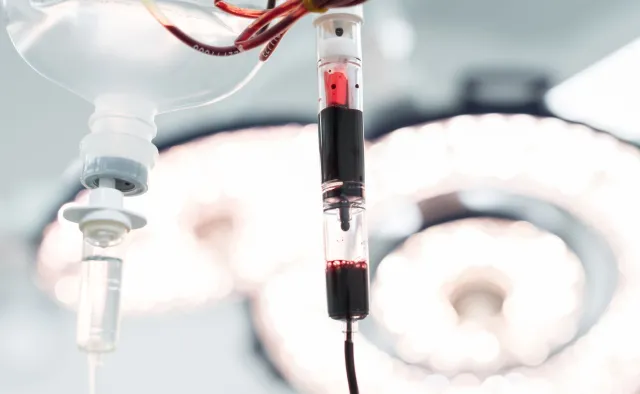 Osocze od ozdrowieńców ma pomóc w leczeniu pacjentów z Covid-19