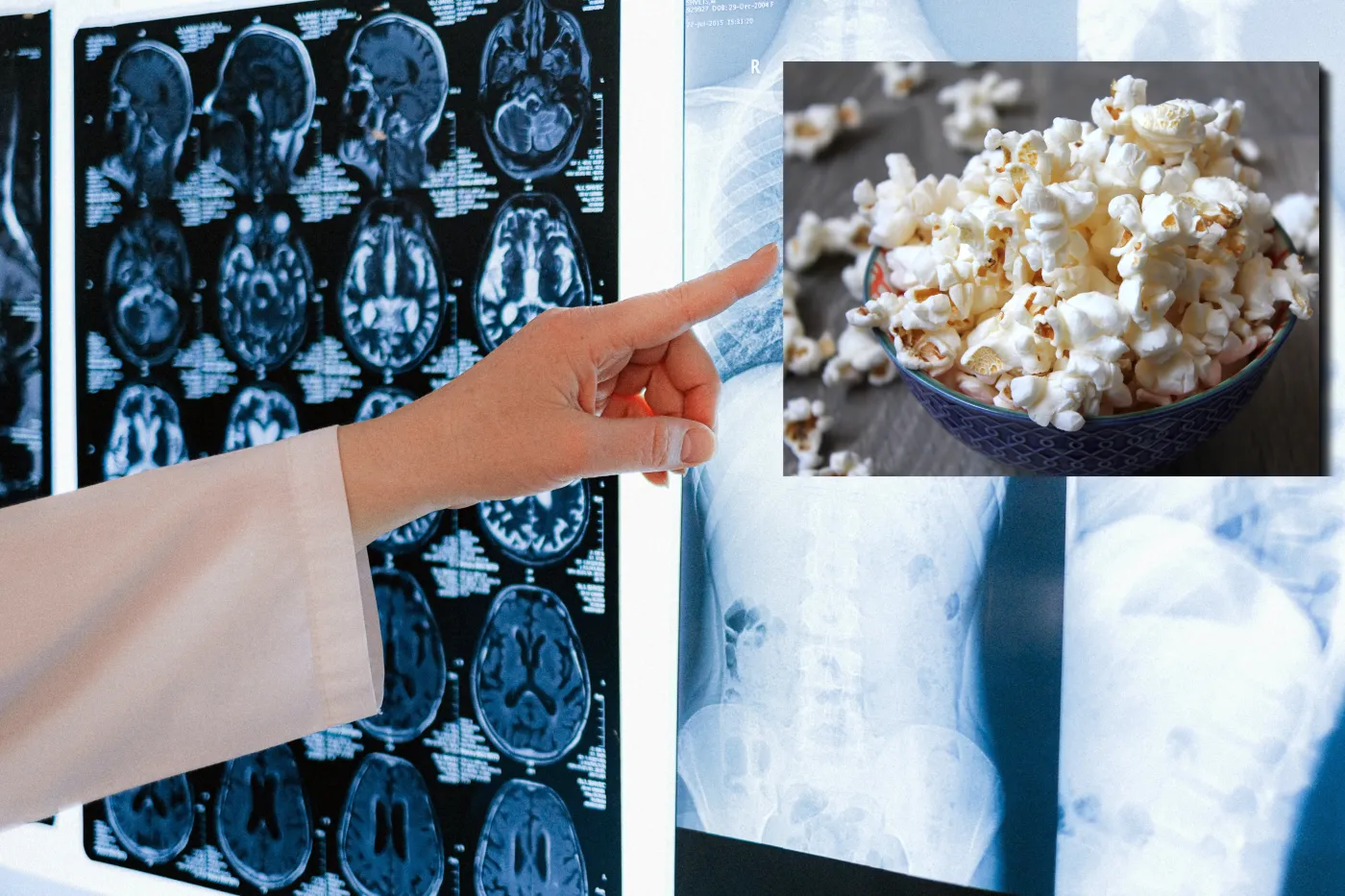 Popcornowe płuca. Brzmi niepoważnie, ale schorzenie jest bardzo groźne