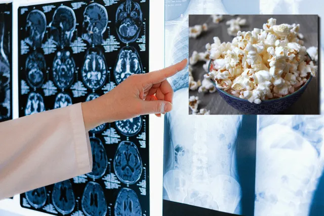 Popcornowe płuca. Brzmi niepoważnie, ale schorzenie jest bardzo groźne