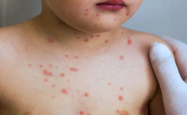 Odra w natarciu. Gdzie zaatakowała tym razem? NAJNOWSZE DANE