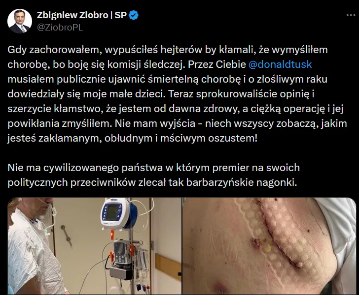 Wpis Zbigniewa Ziobry na portalu X