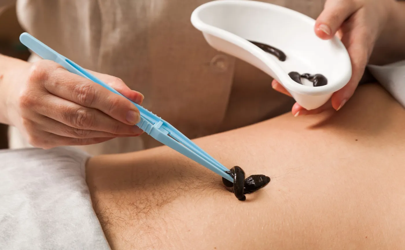 Pijawki lekarskie z Namysłowa zostały zakwalifikowane do badań kosmicznych