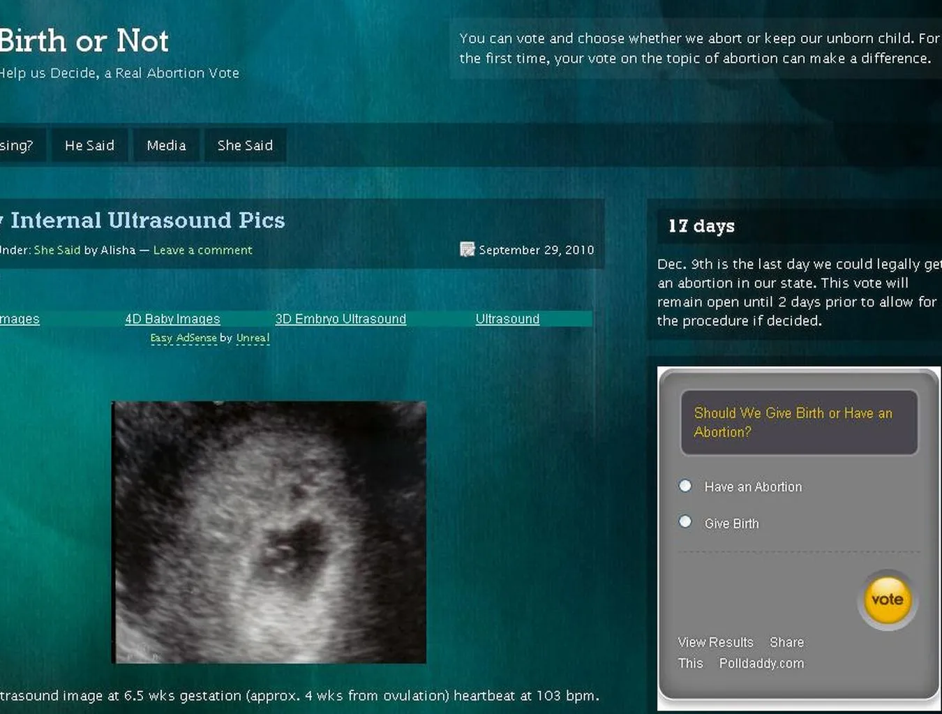 Szokująca sonda! Usunąć ciążę czy nie?