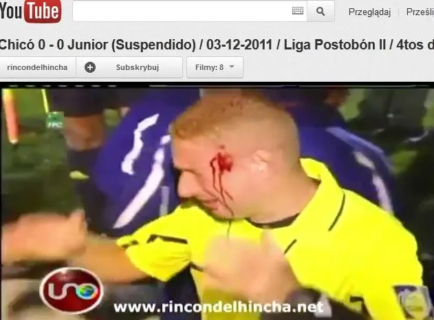 Kibole trafili sędziego petardą w głowę. Wideo