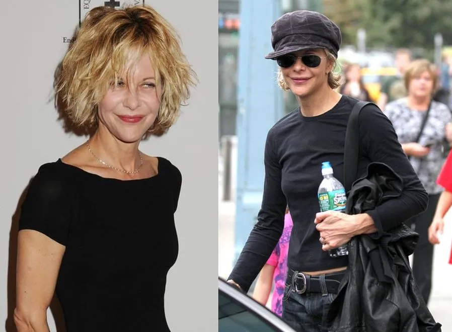 Co się z nią stało? Wielka gwiazda straszy wyglądem