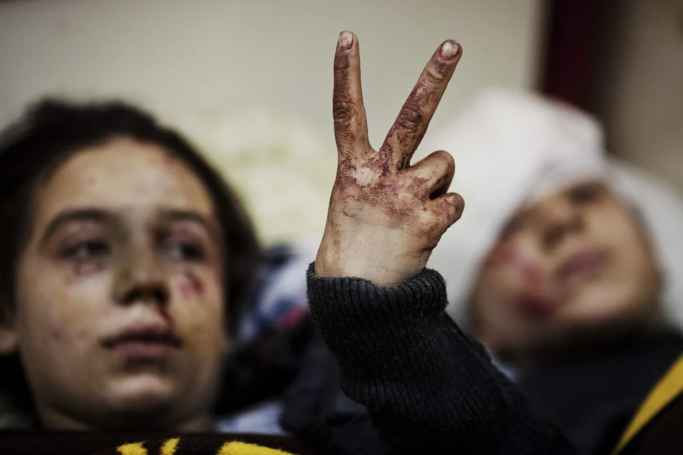 Syryjskie dzieci ranne w bombardowaniu miasta Idlib
