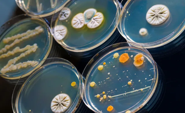 Oporna na antybiotyki superbakteria w Warszawie. Błyskawicznie się rozmnaża [WIDEO]