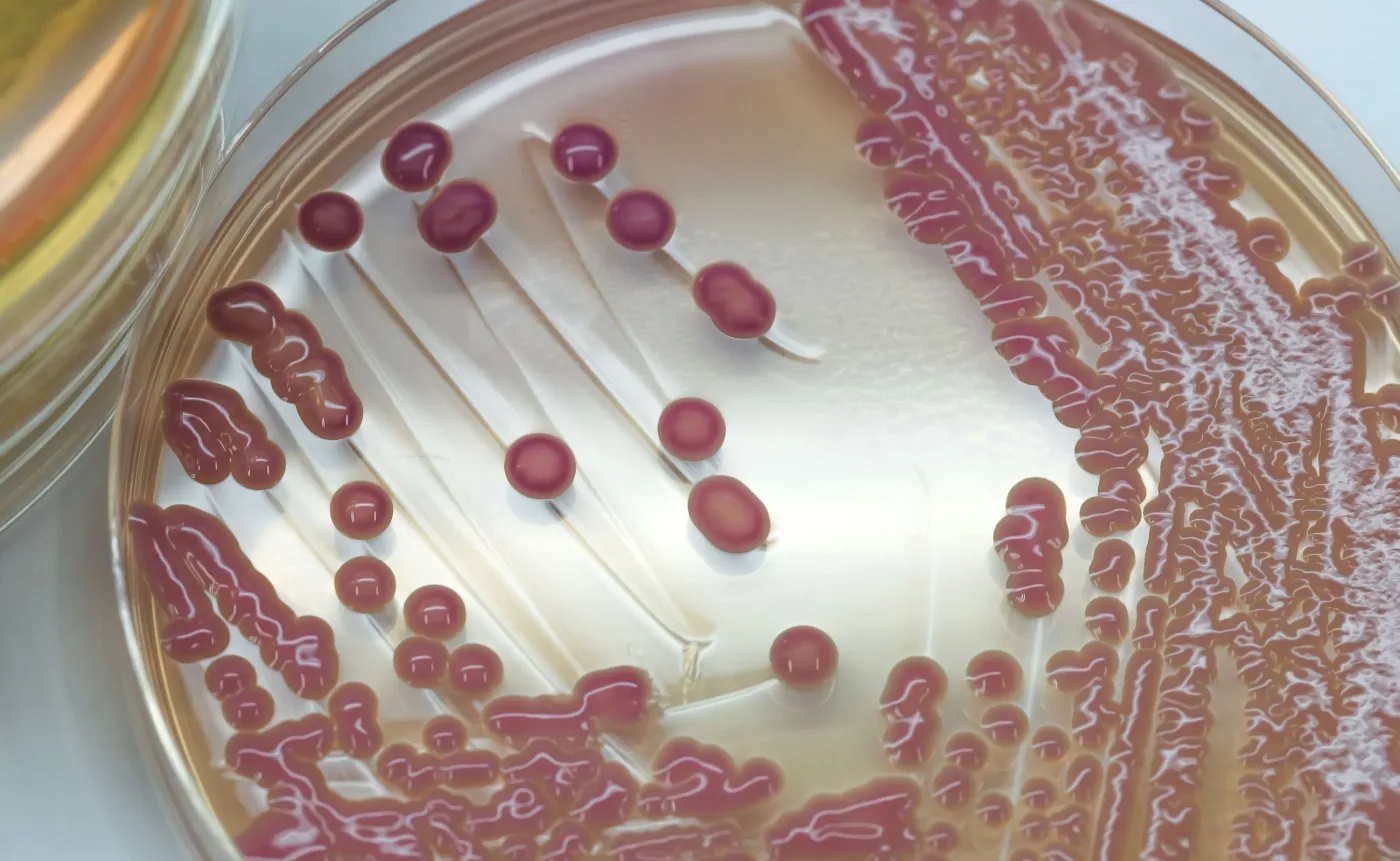 Hodowla bakterii Klebsiella pneumoniae, potocznie zwanych New Delhi