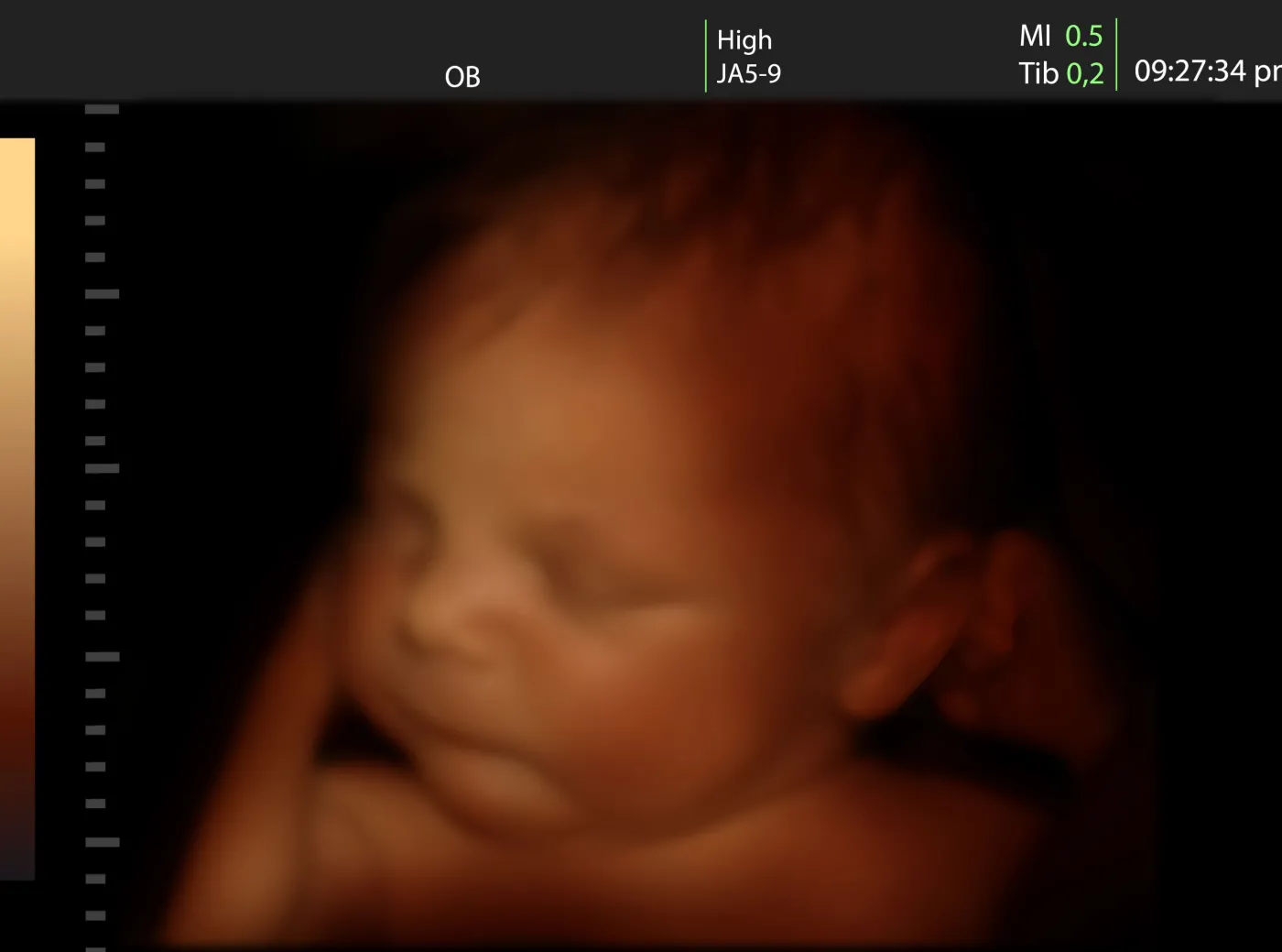 Nieinwazyjne badania prenatalne. Dlaczego warto je zrobić?