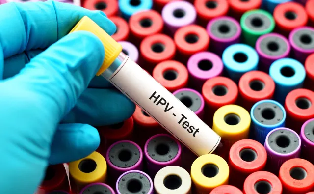 Kiedy będą widoczne efekty programu szczepień przeciw HPV? Wirusolog wyjaśnia