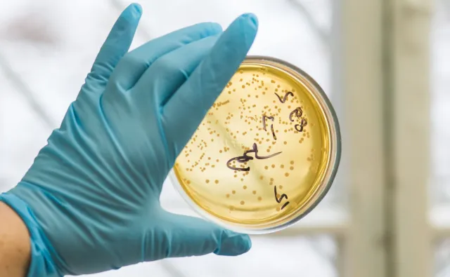 W Polsce 45 ognisk antybiotykoopornej bakterii, najwięcej w Warszawie