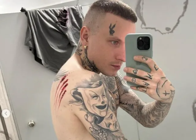Smolasty chce usunąć tatuaże z twarzy. Dlaczego podjął taką decyzję?