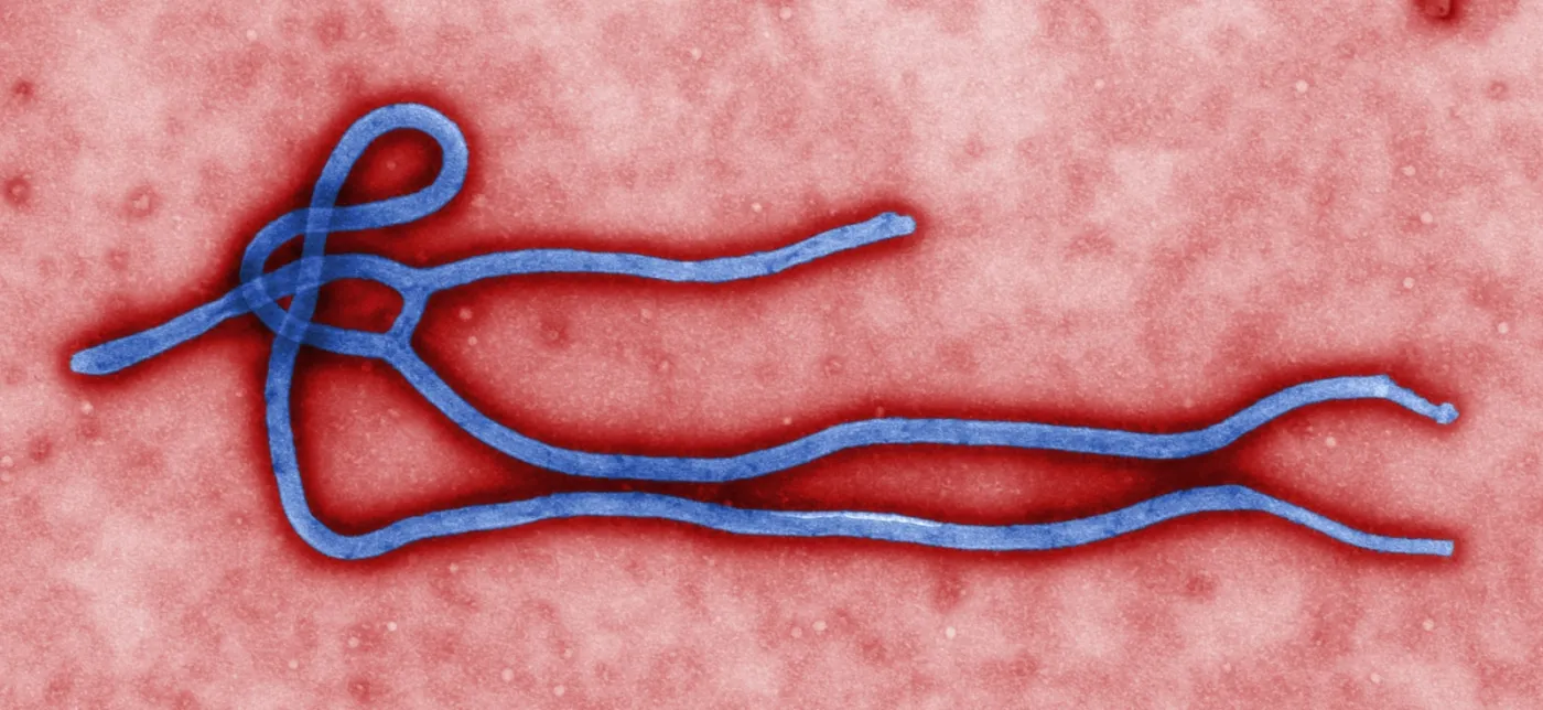 3830826-wirus-ebola.jpg