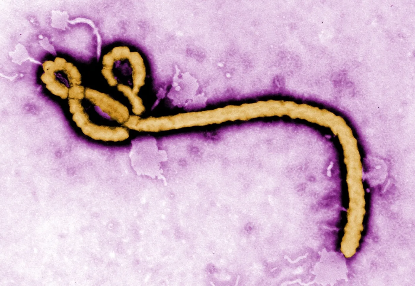Wirus Ebola