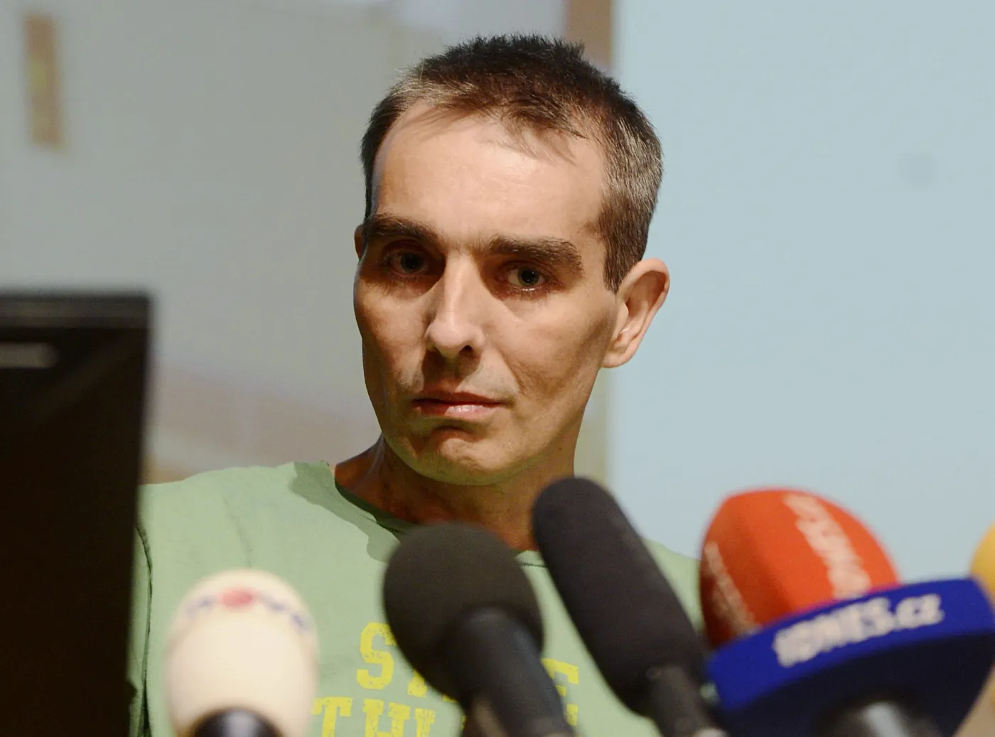 Żyje bez serca. I to już pięć miesięcy