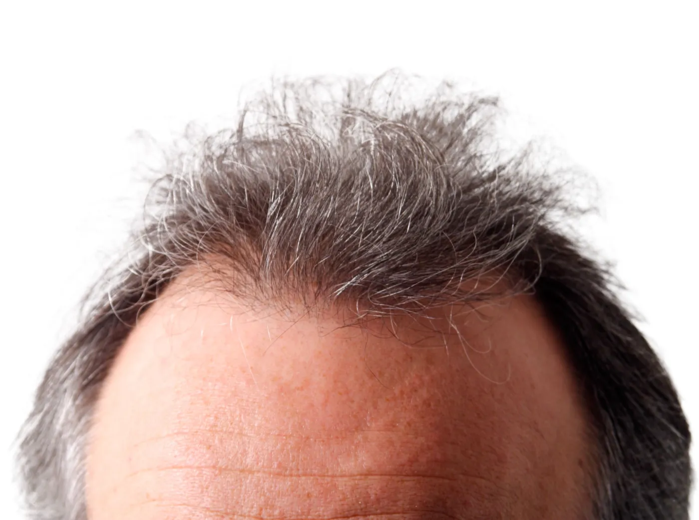 Siwe włosy