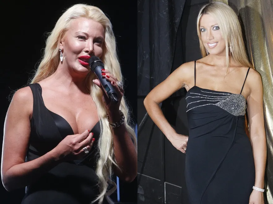 To nie jest przyjemny widok... Isis Gee niewiele brakuje do wyglądu Michaela Jacksona... FOTO