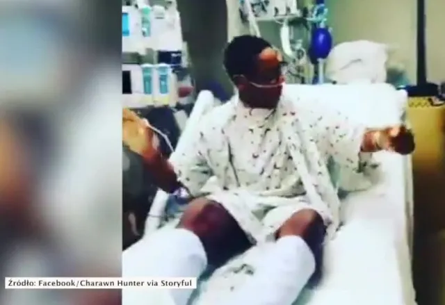 Wykonał taniec szczęścia po udanej transplantacji. Wystawił nowe serce na próbę