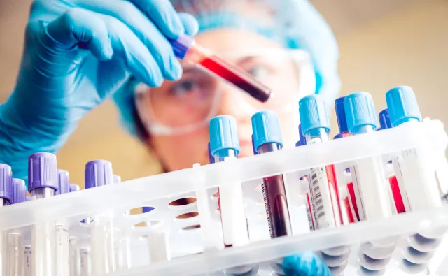 Najbardziej kosztowna choroba hematologiczna? Szpiczak