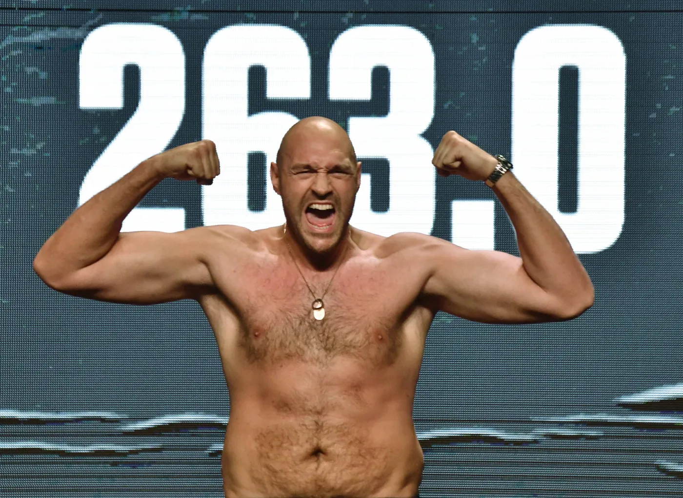 Tyson Fury