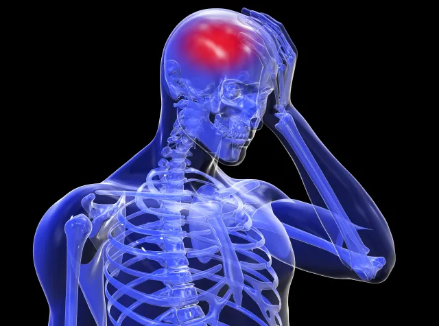 Chip pod skórą może pomóc wykryć kolejny udar