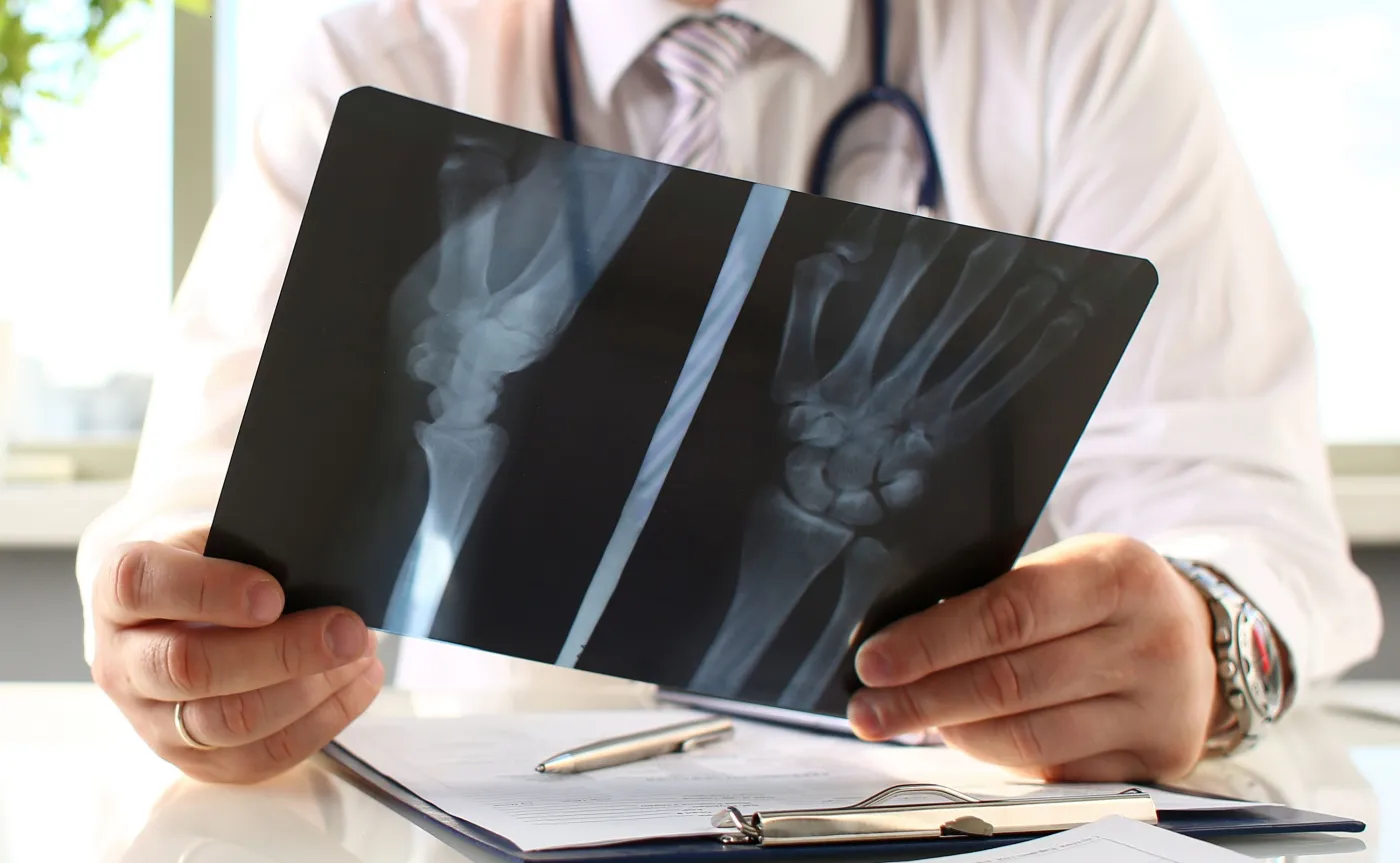 Implant "dekorowany" substancjami dla szybszego gojeni kości. Przełomowe badania