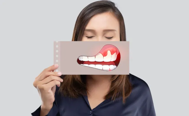 Dziedziczna? Nieuleczalna? Najpopularniejsze mity o paradontozie