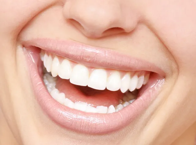 Bonding czy licówki? Specjalista podpowiada