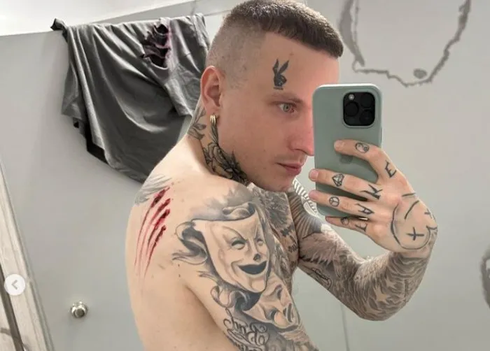 Smolasty chce usunąć tatuaże z twarzy. Dlaczego podjął taką decyzję?