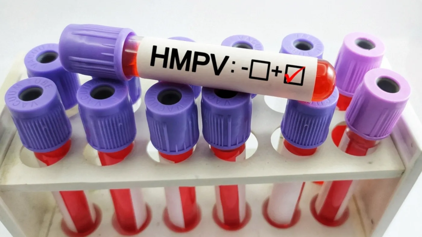 Wirus HMPV będzie się rozprzestrzeniał jak SARS-CoV-2? Ekspertka mówi o ryzyku