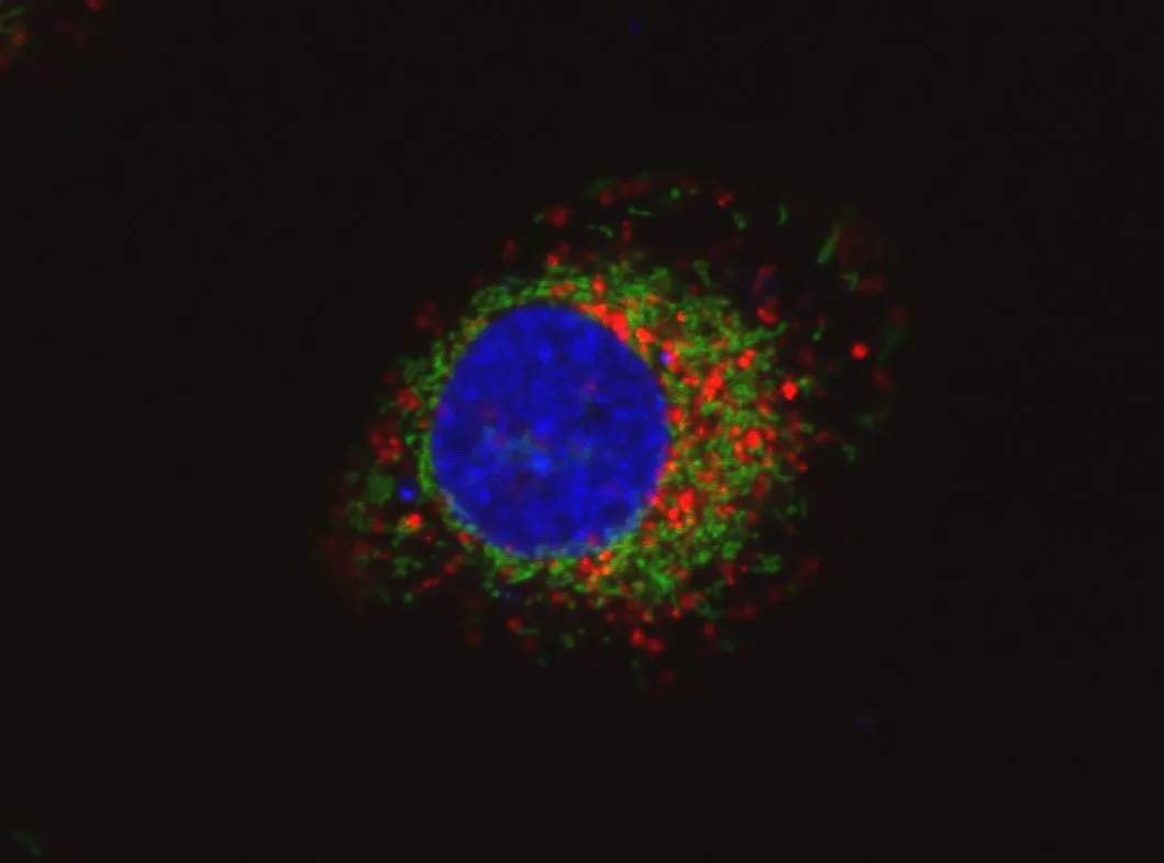 Karta graficzna wykryje raka