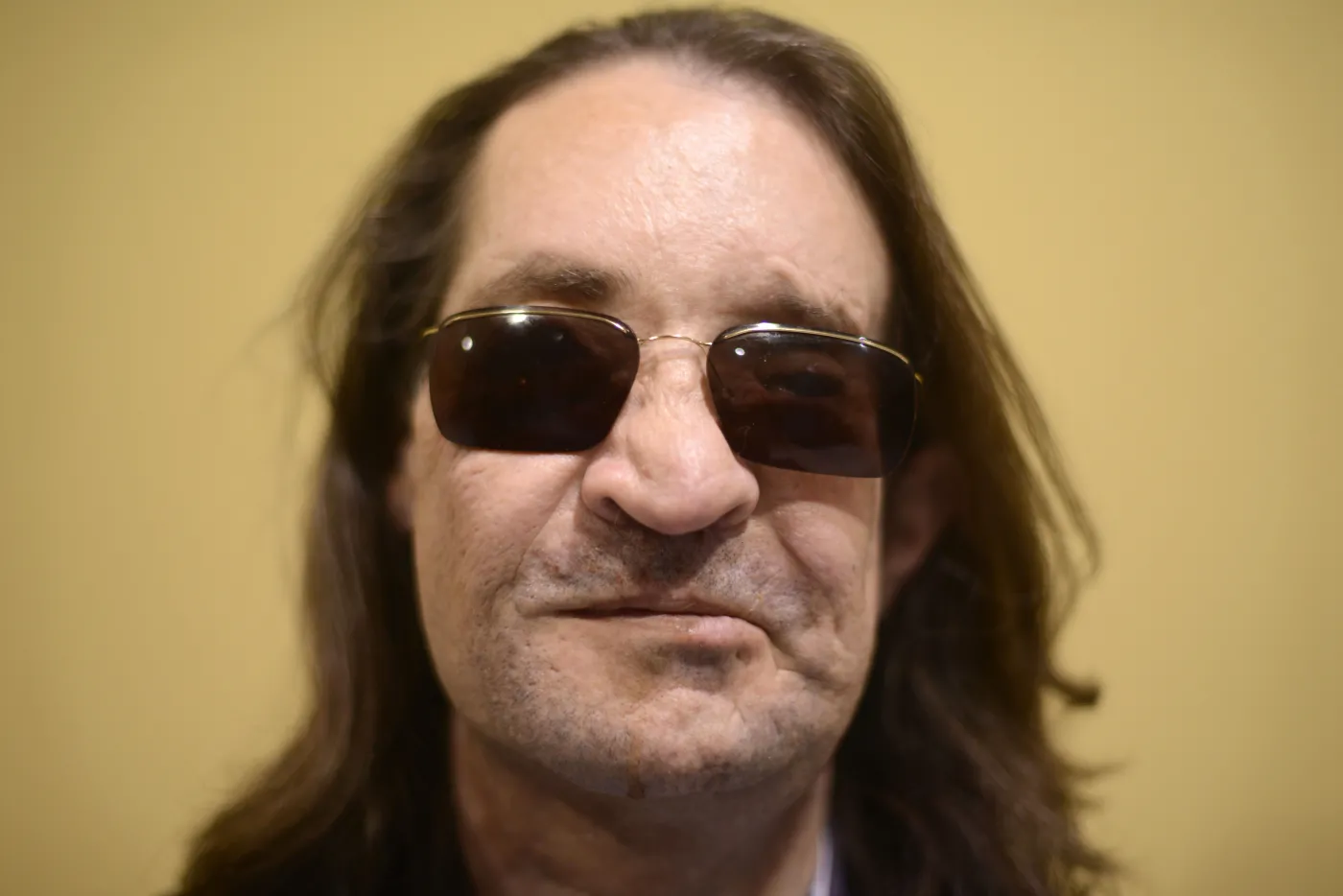 Mężczyzna po przeszczepie twarzy. Niesamowity efekt leczenia. ZDJĘCIA