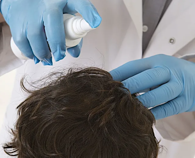 Jak pozbyć się wszy u dziecka?