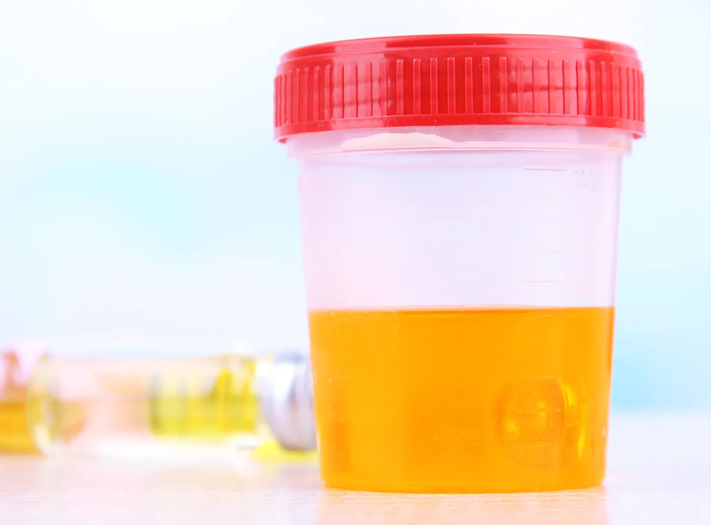 Co trzeba wiedzieć przed oddaniem moczu do analizy?