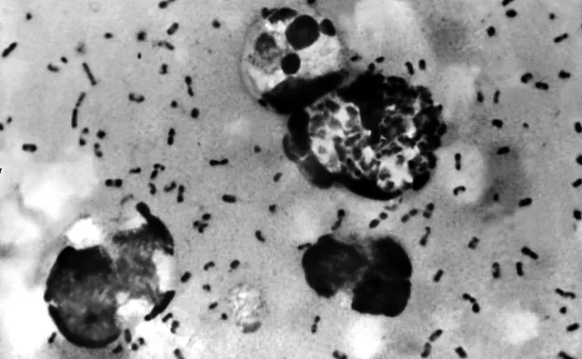 Początki ruchu antyszczepionkowców przywodzą na myśl religijną sektę [FELIETON HISTORYCZNY]