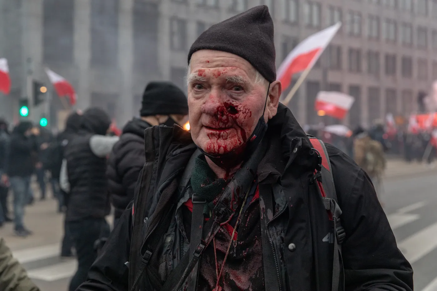 Zraniony przez policję fotoreporter: Będę żądał wysokiego odszkodowania. Może z sześcioma zerami