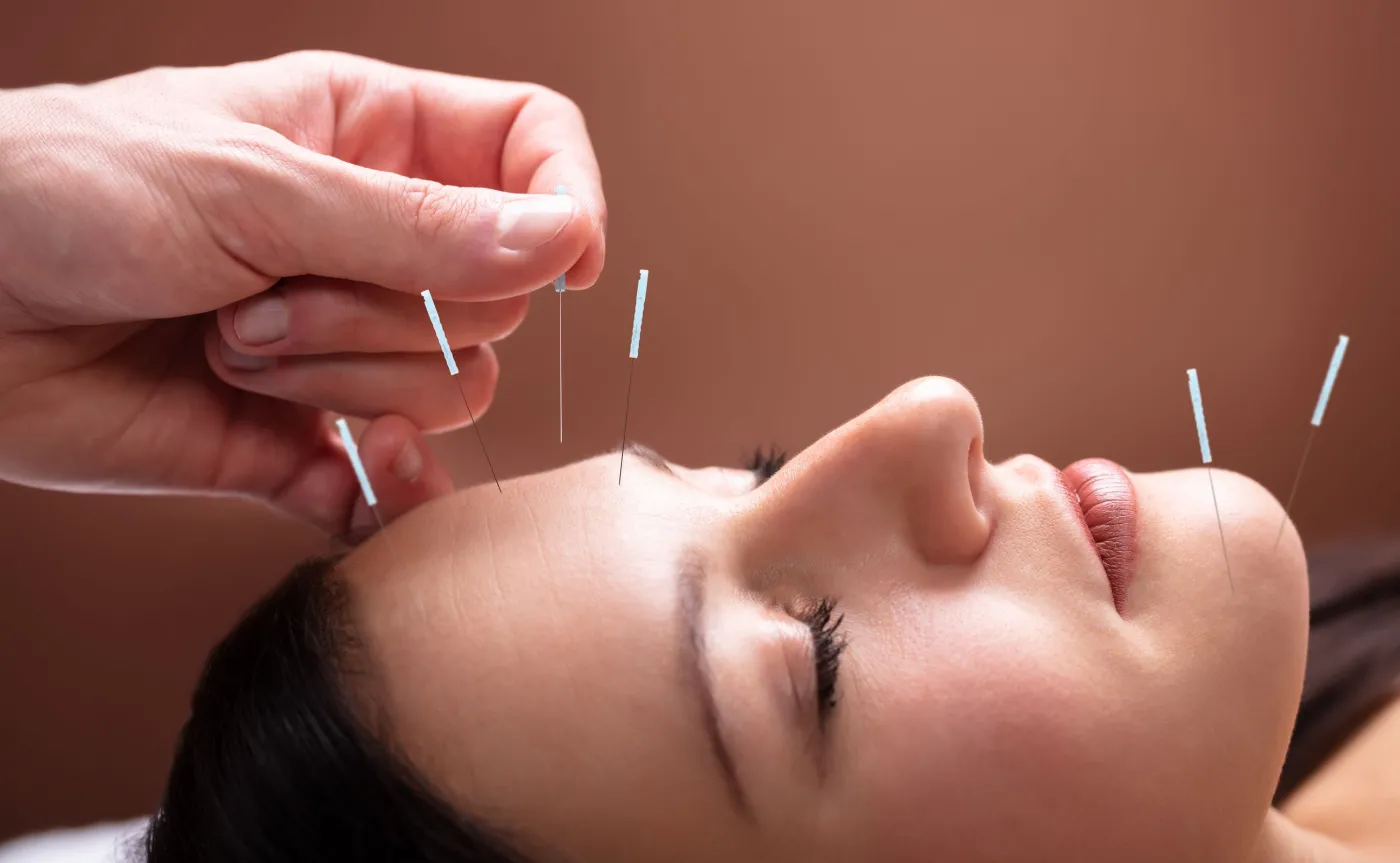 Pozwól nakłuć sobie twarz! Zrób to dla zdrowia, nie tylko dla urody