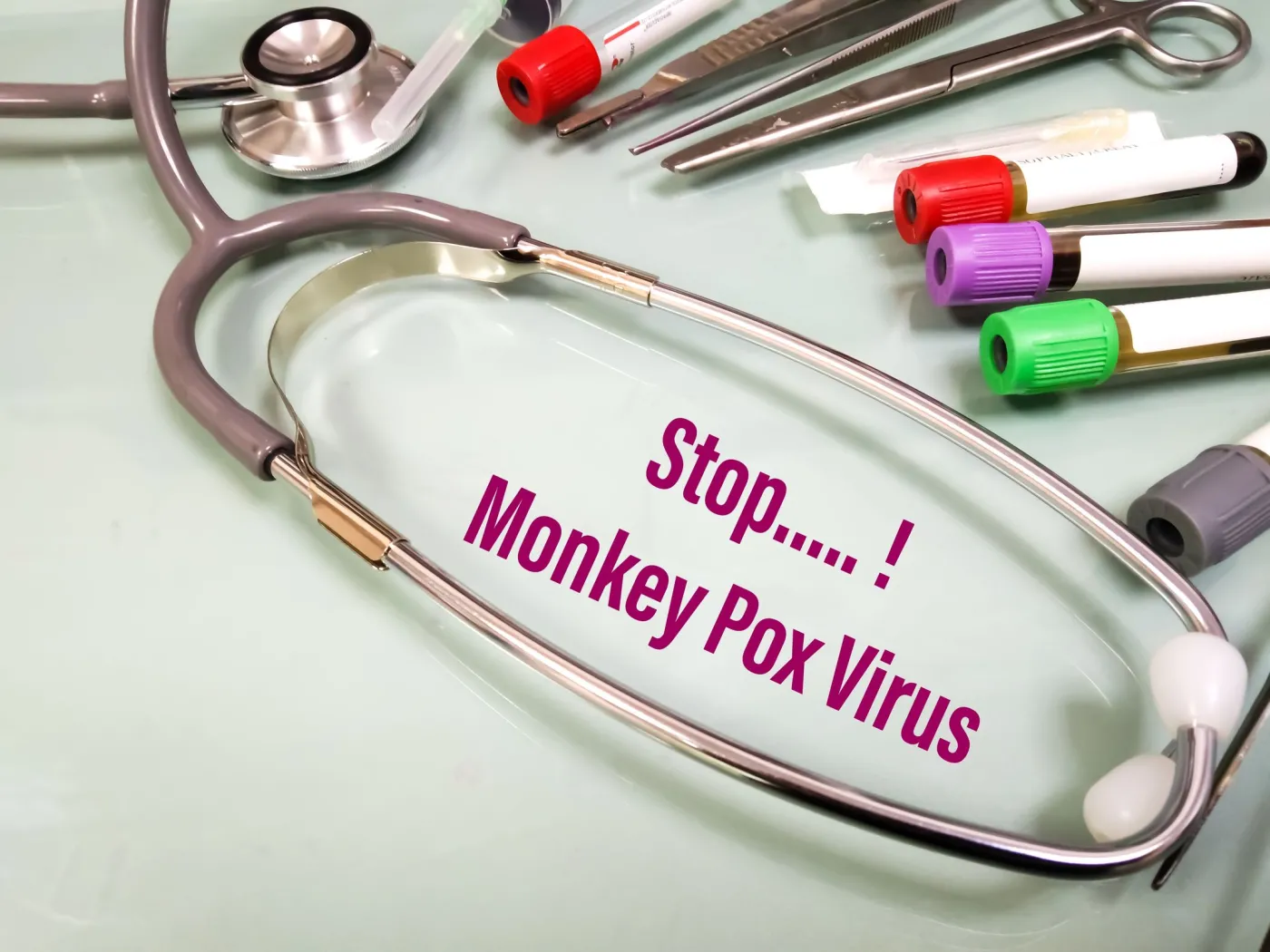 Brytyjscy badacze testują lek przeciwwirusowy przeciwko małpiej ospie