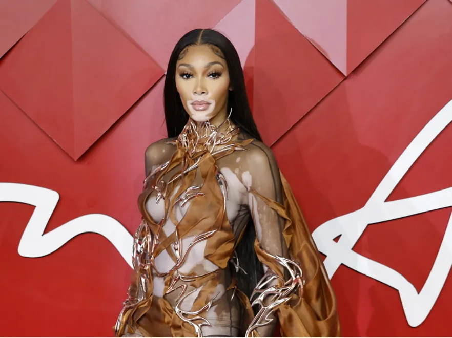 Najsłynniejsza modelka z bielactwem zaprezentowała na ściance ciało w pełnej krasie. Fani: Piękna! [FOTO]