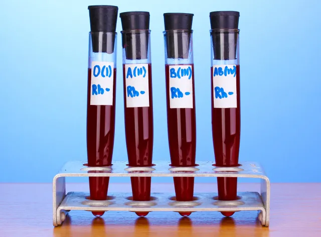 Grupa krwi może wpływać na ryzyko udaru. Która najbardziej?