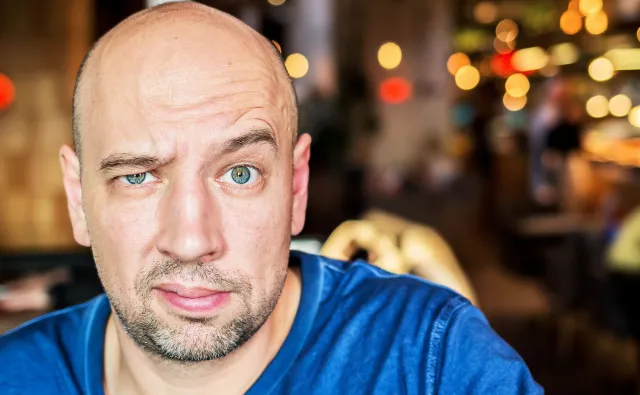 Cała prawda o łysieniu – fakty i mity