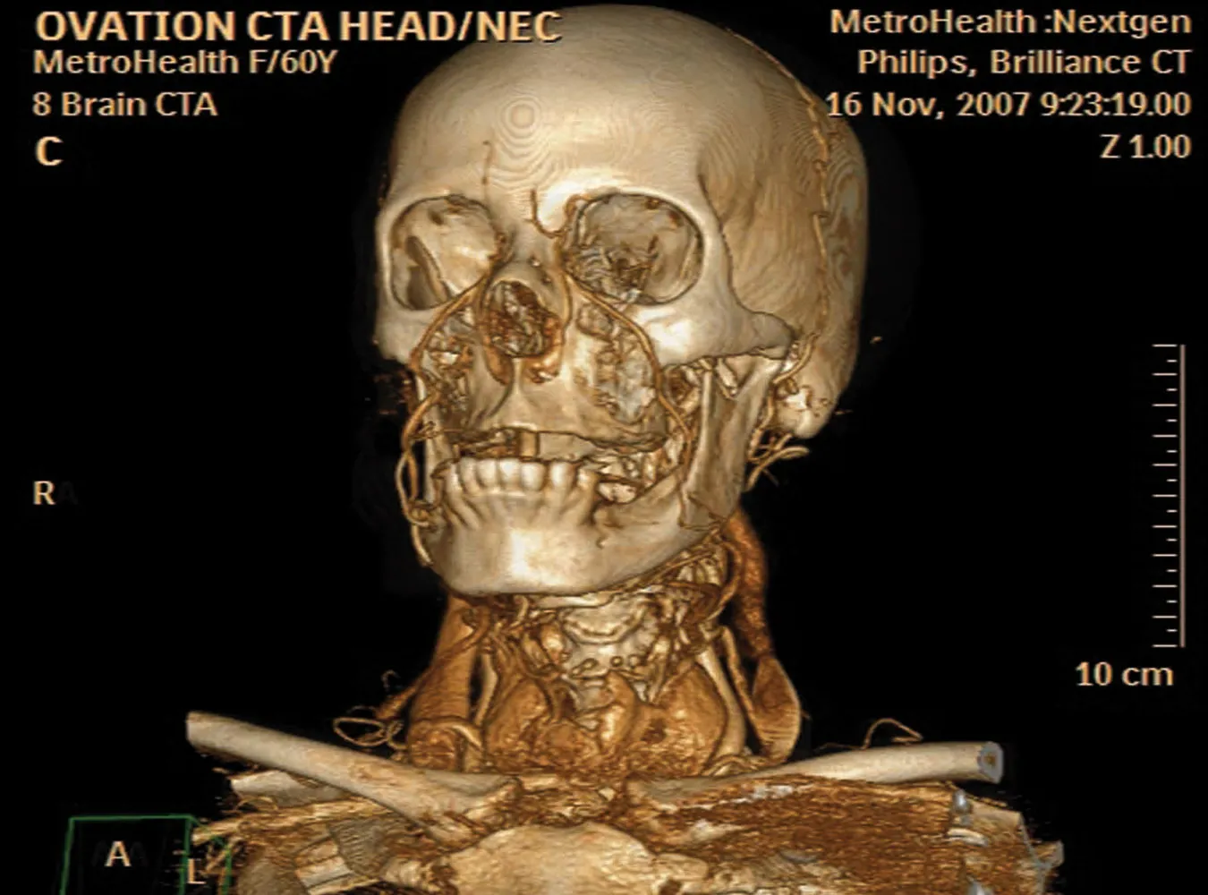 Lekarze przejrzą Cię na wylot