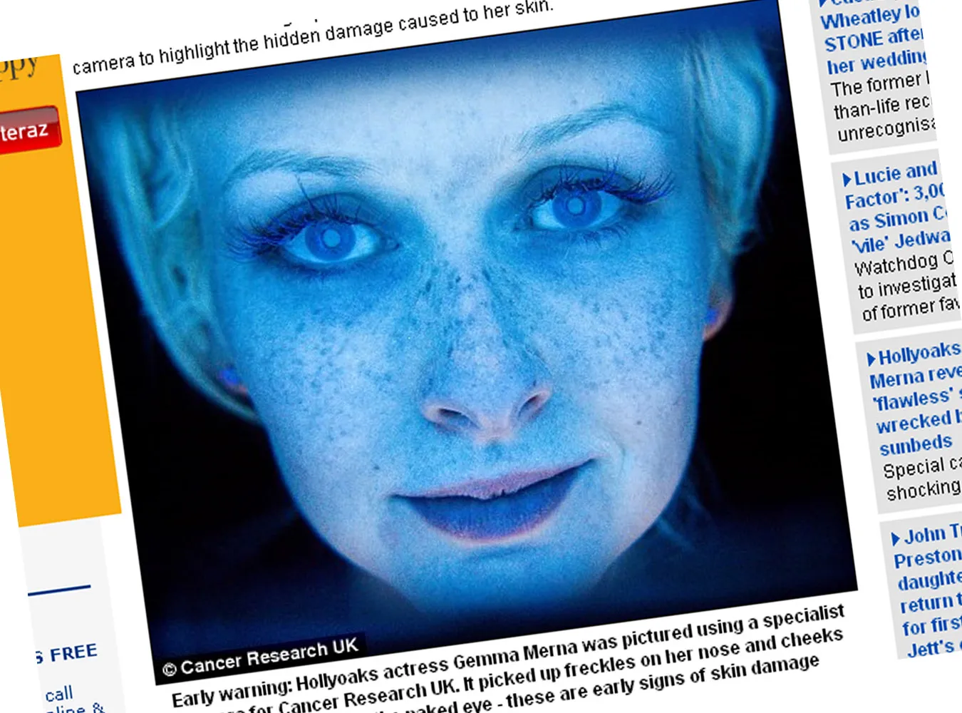 Zobacz, jak solarium zniszczyło jej skórę