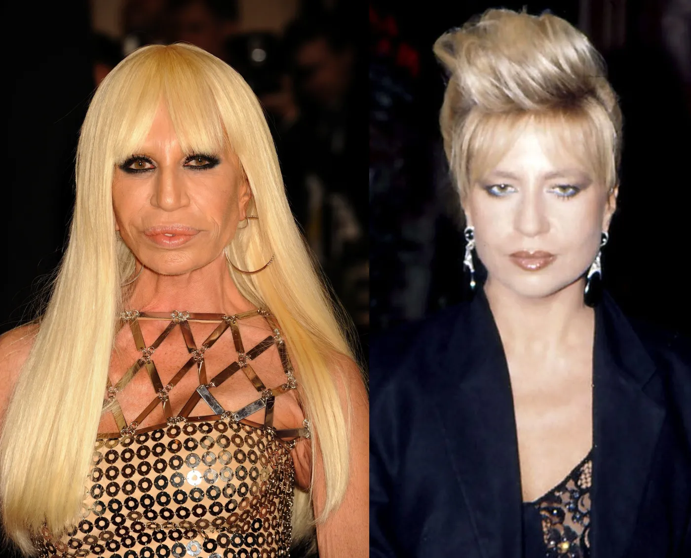 Im skalpel zrobił krzywdę. Zobacz gwiazdy przed i po operacjach plastycznych