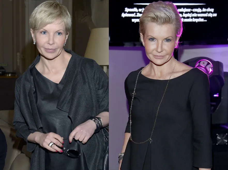 Jest postęp! Joanna Racewicz zaczyna przypominać samą siebie