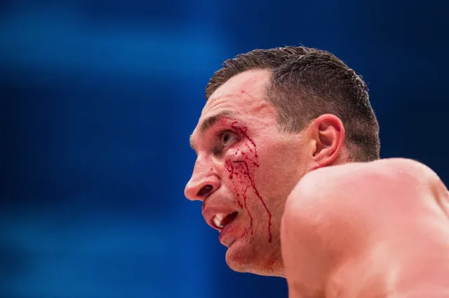 Władimir Kliczko przegrał z Tysonem Furym przez... żonę. WIDEO