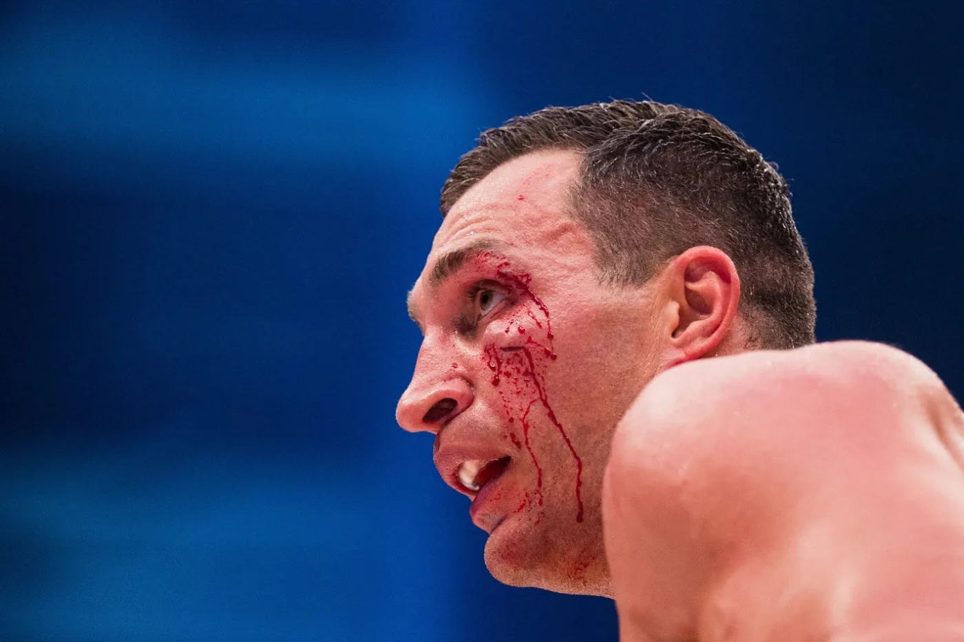 Władimir Kliczko przegrał z Tysonem Furym przez... żonę. WIDEO